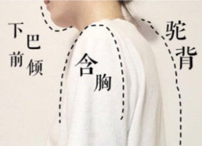 南寧美容學(xué)校：堅(jiān)持一個(gè)月，駝背變直背