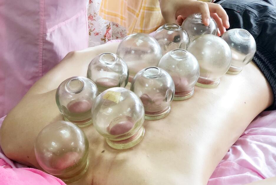 南寧美容課堂：給你拔個火罐吧