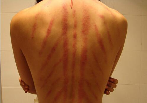 南寧美容學(xué)校：背部按摩的好處與禁忌