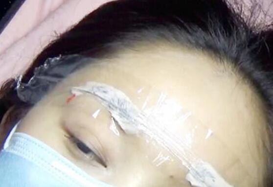 麻藥過后讓眉毛不變形的紋繡技巧