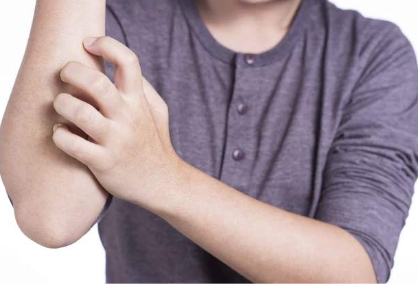 如何應(yīng)對秋冬季節(jié)皮膚干燥瘙癢