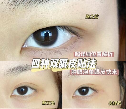 化妝技巧：雙眼皮貼法大全超詳細教程