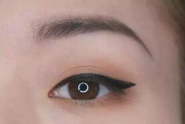 眼尾三角區(qū)怎么處理？