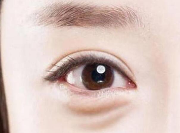 眼袋？淚溝？臥蠶？南寧美容學(xué)校教你辨別
