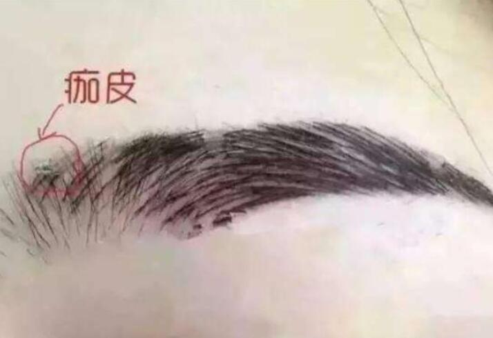紋眉結(jié)痂時(shí)要注意什么？麗紋竹繡學(xué)校教你
