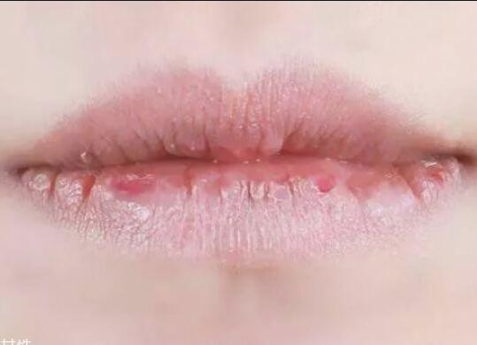 紋唇后嘴巴干燥怎么辦？南寧教紋繡的學(xué)校幫你解決