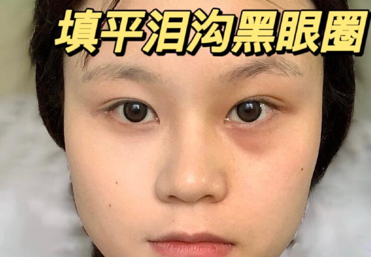 填平淚溝黑眼圈教程，廣西南寧化妝學校分享