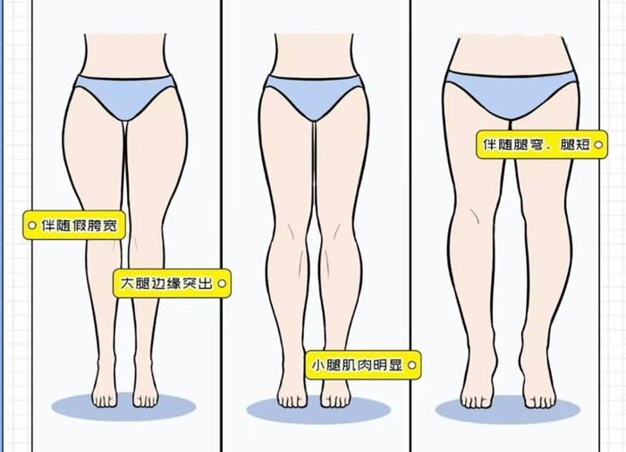 腿粗女生穿搭攻略，廣西彩妝造型搭配