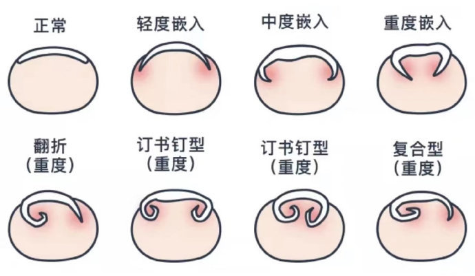 1680749355105238.jpg 3.jpg