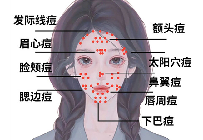 痘（dou）痘修復攻略,廣西皮膚管理中心分享