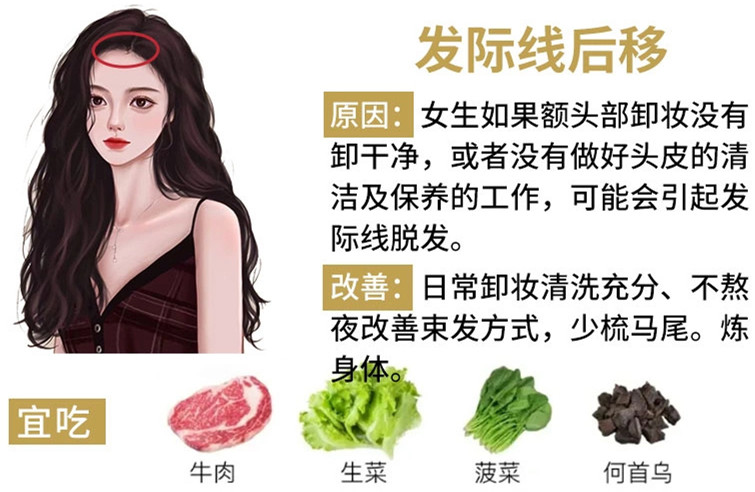 如何改善掉頭發(fā)？南寧頭療養(yǎng)發(fā)護(hù)發(fā)教學(xué)