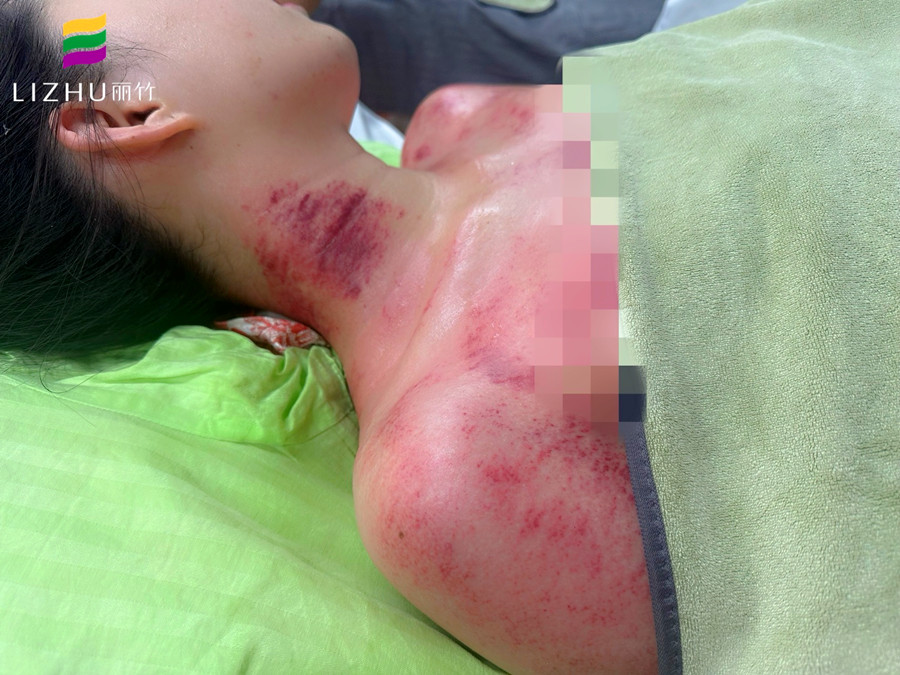 廣西學刮痧培訓班 | 廣西學刮痧學費多少？